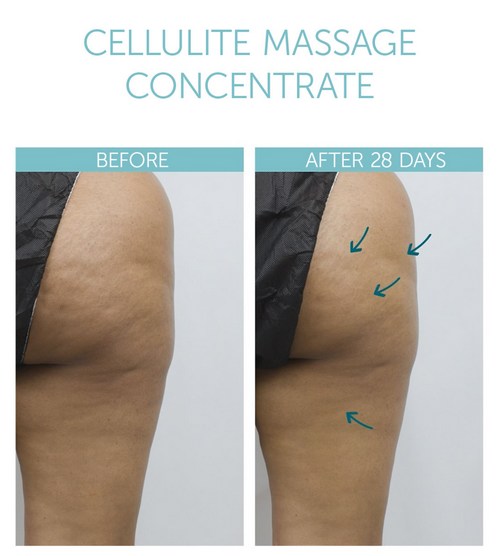Cellulite Massage Concentrate 3
